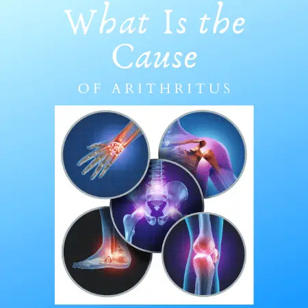 What Is the Cause of Arthritis