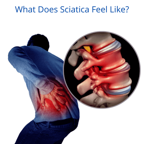 what does sciatica feel like