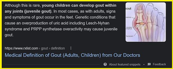 can babies and children get gout - what is juvenile gout screenshot
