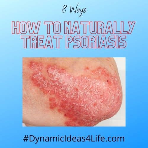 how to naturally treat psoriasis