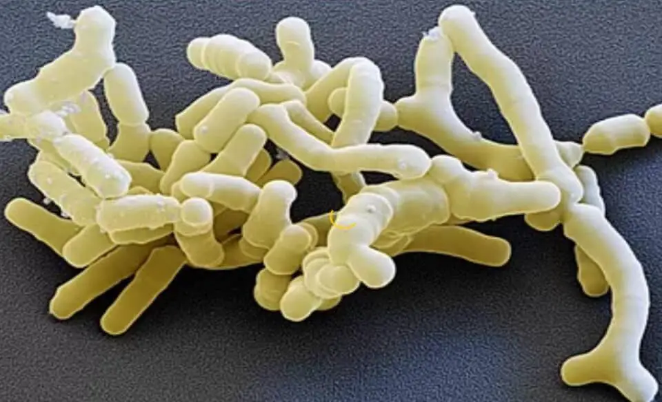 Bifidobacterium Bifidum probiotics for the elderly