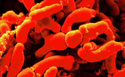 Bifidobacterium Breve probiotics