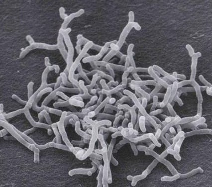 Bifidobacterium Longum in probiotics