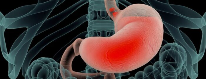 stomach acid x ray